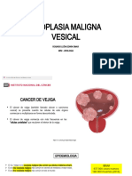 Neoplasia Maligna Vesical LAPTOP