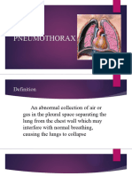 Pneumothorax