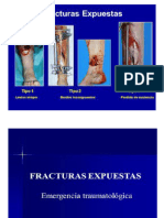 Fractura Expuesta