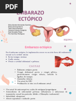 Embarazo Ectopico Completo