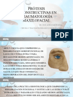 Prótesis Reconstructivas en Traumatología Maxilofacial