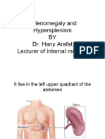 Splenomegaly