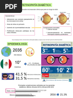 Retinopatía Diabética