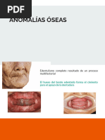 Anomalias Oseas