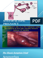 4th - ECTOPIC, H.MOLE, H.GRAVIDARUM, 3RD TRI. BLDG.