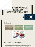 Enfermedad Por Reflujo Gastroesofágico