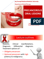 Precancerous Lesions of Oral Cavity