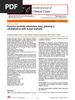 1 Posterior Partially Edentulous Jaws, Planning A