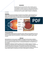 Conjuntivitis