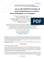 Evans Syndrome As The Initial Presentation of Systemic Lupus Erythromatosus in A Rural Kenyan Hospital: A Case Report