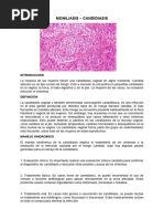 Candidiasis Vaginal - Ultima Redaccion