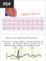 Arritmias