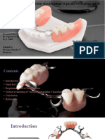 Critical Analysis of RPD Classification System