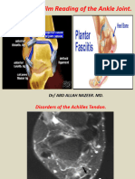 Ankle MRI