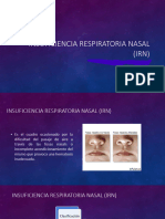 Insuficiencia Respiratoria Nasal (IRN) : Presentado Por: Grupo 2