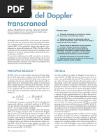 Utilidad Del Doppler Transcraneal: Puesta Al Día en Las Técnicas