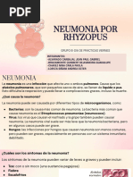 Neumonia