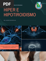 HIPERTIROIDISMO