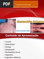 Dermatite Atopica