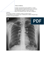 Radiografia de Torax Normal