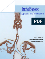 Tracheal Stenosis Diagnosis and Treatment Small