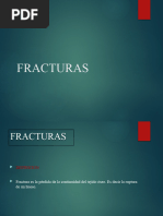 Fracturas Itup