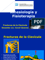 4 - Clavicula Fractura Lux Ac CL