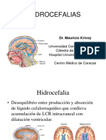 Hidrocefalia