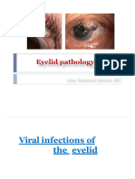 Eyelid Pathology 2