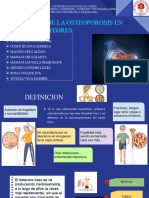 Abordaje de La Osteoporosis en Mujeres Mayores