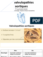 Cardio4an-Valvulopathies Aortiques2022foudad