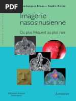 Imagerie Nasosinusienne