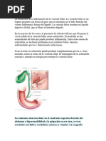 COLECISTITIS