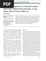 Clinical Management of A Fractured Anterior Tooth With Reattachment Technique A Case Report With An 8-Year Follow Up