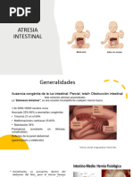 Atresia Intestinal 1