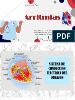 Arritmias - Cardiopatia Isquemica.