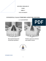 Pyriform Aperture Stenosis