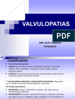 Valvulopatias