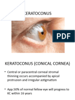 KERATOCONUS