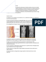 Anatomia Colon y Recto