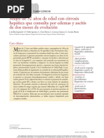 Mujer de 52 Años de Edad Con Cirrosis Hepática Que Consulta Por Edemas y Ascitis de Dos Meses de Evolución