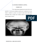 Tecnica Posteroanterior de Caldwell