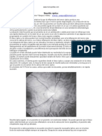 Neuritis Optica Enfermedad Ojos