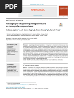 Hallazgos Por Imagen de Patología Dentaria en Tomografía Computarizada