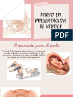 Parto de Vértice