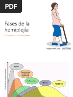 Fases de La Hemiplejía y Objetivos de Tratamiento Post ACV