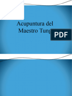 Acupuntura Del Maestro Tung