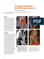 SIE CT 21 533 CaseStudy BAPV Malformation