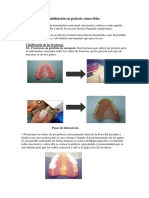 Rehabilitación en Prótesis Removible 2013