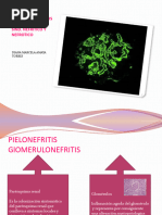 GLOMERULONEFRITIS SX Nefritico, Nefrotico